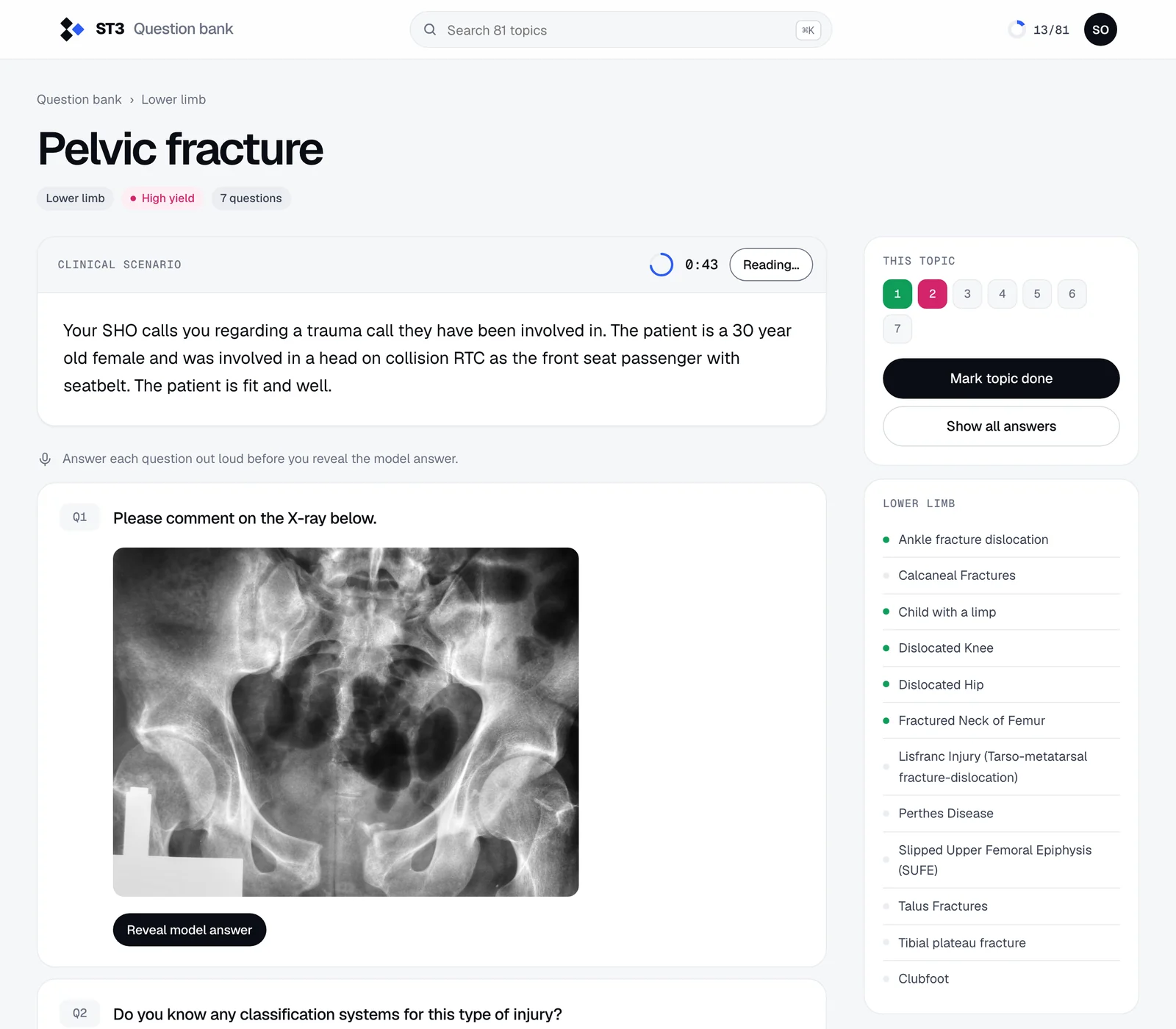 A question bank topic: the clinical scenario with a one-minute timer and the examiner’s questions